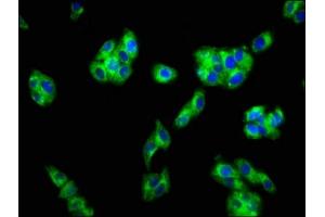 Immunofluorescence staining of HepG2 cells with ABIN7153159 at 1:133, counter-stained with DAPI. (FFAR1 Antikörper  (AA 143-178))