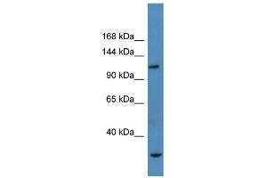 WB Suggested Anti-Ap3b1 Antibody Titration:  0. (AP3B1 Antikörper  (N-Term))