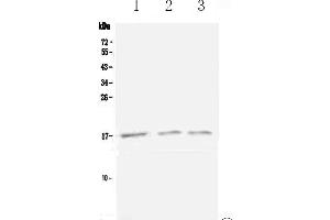 Western blot analysis of Lymphotactin using anti-Lymphotactin antibody . (XCL1 Antikörper  (AA 22-114))