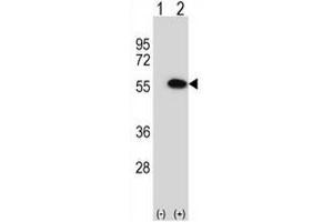 Western blot analysis of MINA (arrow) using rabbit polyclonal MINA Antibody (N-term) .