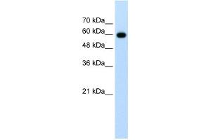 WB Suggested Anti-CDC23 Antibody Titration:  1. (CDC23 Antikörper  (N-Term))