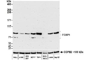 Western Blotting (WB) image for anti-Forkhead Box P1 (FOXP1) (AA 627-677) antibody (ABIN7454010)