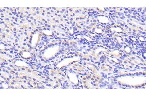 Detection of SLC39A7 in Human Kidney Tissue using Polyclonal Antibody to Solute Carrier Family 39, Member 7 (SLC39A7) (SLC39A7 Antikörper  (AA 171-469))