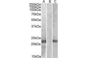 Western Blotting (WB) image for anti-Cystatin 8 (CST8) (Internal Region) antibody (ABIN2464863) (CST8 Antikörper  (Internal Region))