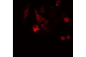 ABIN6277987 staining  Hela cells by IF/ICC. (Calretinin Antikörper  (Internal Region))