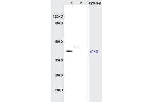 Lane 1: rat brain lysates Lane 2: rat heart lysates probed with Anti AGPAT4 Polyclonal Antibody, Unconjugated  at 1:200 in 4˚C. (AGPAT4 Antikörper  (AA 231-330))