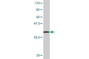 Western Blot detection against Immunogen (36. (ATG5 Antikörper  (AA 176-275))