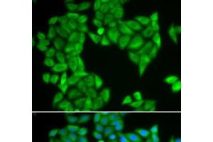 Immunofluorescence analysis of HeLa cells using SPAG5 Polyclonal Antibody (SPAG5 Antikörper)