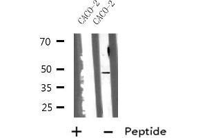 Western blot analysis of HSD17B2 using CACO-2 whole cell lysates (HSD17B2 Antikörper  (C-Term))