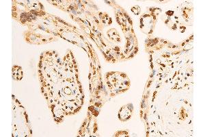 ABIN6267301 at 1/100 staining human placenta tissue sections by IHC-P. (EIF2S1 Antikörper  (pSer51))