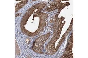 Immunohistochemical staining of human gallbladder with CCNY polyclonal antibody  shows strong cytoplasmic and membranous positivity in glandular cells at 1:50-1:200 dilution. (Cyclin Y Antikörper)