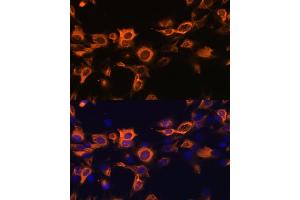 Immunofluorescence analysis of C6 cells using CSF2 antibody (ABIN6130426, ABIN6139094, ABIN6139095 and ABIN6221725) at dilution of 1:100. (GM-CSF Antikörper  (AA 18-144))