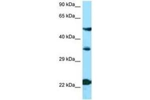 Image no. 1 for anti-Melanocortin 4 Receptor (MC4R) (N-Term) antibody (ABIN6748393) (MC4R Antikörper  (N-Term))