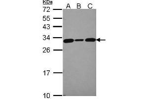 WB Image Sample (30 ug of whole cell lysate) A: 293T B: A431 , C: JurKat 12% SDS PAGE antibody diluted at 1:5000 (CACYBP Antikörper)