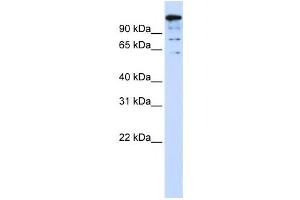 Western Blotting (WB) image for anti-BTB and CNC Homology 1, Basic Leucine Zipper Transcription Factor 2 (BACH2) antibody (ABIN2458413) (BACH2 Antikörper)