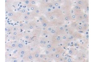 Detection of MMP3 in Human Liver Tissue using Monoclonal Antibody to Matrix Metalloproteinase 3 (MMP3) (MMP3 Antikörper  (AA 363-477))