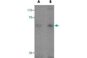 Western blot analysis of TICAM1 in human lung tissue lysates with TICAM1 polyclonal antibody  at (A) 2 and (B) 4 ug/mL . (TICAM1 Antikörper  (C-Term))
