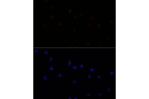 Immunofluorescence analysis of L929 cells using C antibody (ABIN7266034) at dilution of 1:100. (Calpain 7 Antikörper  (AA 20-220))