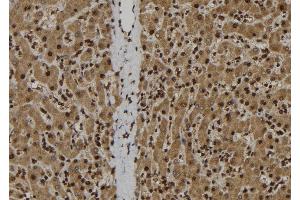 ABIN6278308 at 1/100 staining Human liver tissue by IHC-P. (IL-33 Antikörper  (Internal Region))
