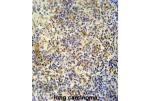 Immunohistochemistry (IHC) image for anti-KRI1 Homolog (KRI1) antibody (ABIN2995581) (KRI1 Antikörper)