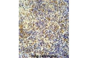 Immunohistochemistry (IHC) image for anti-KRI1 Homolog (KRI1) antibody (ABIN5015220) (KRI1 Antikörper)