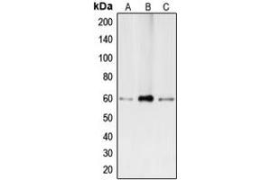 Western blot analysis of BMP2 expression in Caco2 (A), HepG2 (B), THP1 (C) whole cell lysates. (BMP2 Antikörper  (Center))
