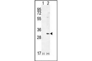 Western blot analysis of HMOX1 (arrow) using Heme oxygenase 1 / HMOX1 Antibody (Center) Cat. (HMOX1 Antikörper  (Middle Region))