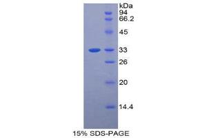 SDS-PAGE (SDS) image for Bone Marrow Stromal Cell Antigen 1 (BST1) (AA 28-282) protein (His tag) (ABIN2124138)