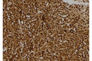 ABIN6275163 at 1/100 staining Rat kidney tissue by IHC-P. (GIDRP88 Antikörper  (C-Term))