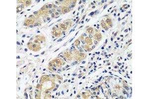 Immunohistochemistry of paraffin-embedded Human stomach using GPRC5A Polyclonal Antibody at dilution of 1:100 (40x lens).