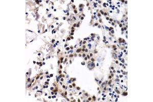 Immunohistochemistry (IHC) image for anti-Inhibitor of DNA Binding 3, Dominant Negative Helix-Loop-Helix Protein (ID3) (AA 1-119) antibody (ABIN6142140)