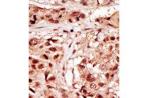 Image no. 2 for anti-TP53 Regulating Kinase (TP53RK) (Middle Region) antibody (ABIN360571) (TP53RK Antikörper  (Middle Region))