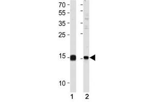 SUMO2/3 antibody western blot analysis in (1) 293 and (2) HeLa lysate (SUMO2/3 Antikörper  (AA 53-84))