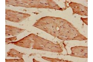 Immunohistochemistry of paraffin-embedded human skeletal muscle tissue using ABIN7172082 at dilution of 1:100