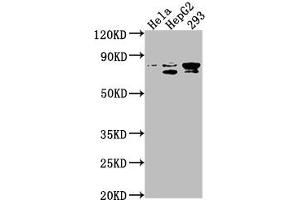 Western Blot Positive WB detected in: Hela whole cell lysate, HepG2 whole cell lysate, 293 whole cell lysate All lanes: SRPK2 antibody at 1:1000 Secondary Goat polyclonal to rabbit IgG at 1/50000 dilution Predicted band size: 78, 80 kDa Observed band size: 78 kDa (SRPK2 Antikörper  (AA 471-688))