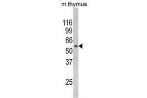 Image no. 1 for anti-Regulator of Chromosome Condensation (RCC1) and BTB (POZ) Domain Containing Protein 2 (RCBTB2) (N-Term) antibody (ABIN452843) (RCBTB2 Antikörper  (N-Term))