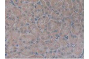 IHC-P analysis of Rat Kidney Tissue, with DAB staining. (Growth Hormone Receptor Antikörper  (AA 353-588))