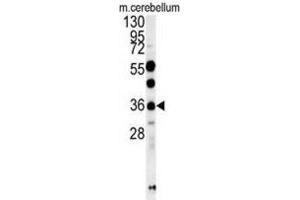 Western Blotting (WB) image for anti-OTU Domain Containing 6B (OTUD6B) antibody (ABIN3002448) (OTUD6B Antikörper)