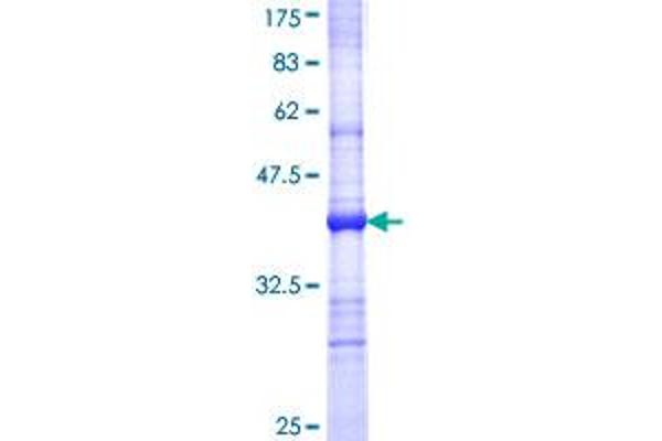 TLR6 Protein (AA 201-300) (GST tag)