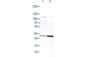 Western blot analysis of Lane 1: NIH-3T3 cell lysate (Mouse embryonic fibroblast cells) Lane 2: NBT-II cell lysate (Rat Wistar bladder tumour cells) with CYC1 polyclonal antibody  at 1:100-1:250 dilution. (Cytochrome C1 Antikörper)
