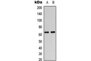 Western blot analysis of DGK epsilon expression in HeLa (A), HEK293T (B) whole cell lysates. (DGKE Antikörper  (Center))
