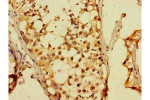Immunohistochemistry of paraffin-embedded human testis tissue using ABIN7150619 at dilution of 1: 100 (DUX4 Antikörper  (AA 217-402))