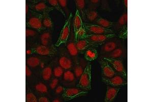 Immunofluorescence (IF) image for anti-Keratin 7 (KRT7) antibody (ABIN6939874)