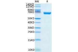 CD38 Protein (AA 43-300) (Fc Tag)