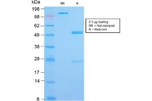 SDS-PAGE Analysis Purified IL3RA Rabbit Recombinant Monoclonal Antibody (IL3RA/2947R). (Rekombinanter IL3RA Antikörper  (AA 26-171))