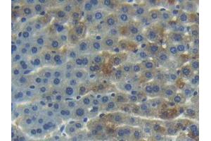 IHC-P analysis of Mouse Liver Tissue, with DAB staining. (ANG Antikörper  (AA 25-145))