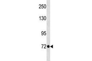 TBR2 antibody western blot analysis in A375 lysate. (EOMES Antikörper  (AA 28-57))
