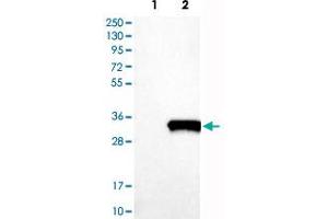 Western Blot analysis of Lane 1: negative control (vector only transfected HEK293T cell lysate) and Lane 2: over-expression lysate (co-expressed with a C-terminal myc-DDK tag in mammalian HEK293T cells) with SNAP25 polyclonal antibody . (SNAP25 Antikörper)