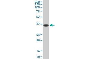 Western Blotting (WB) image for anti-PDZ Binding Kinase (PBK) (AA 1-110) antibody (ABIN599274) (PBK Antikörper  (AA 1-110))