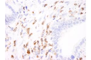 Immunohistochemistry (IHC) image for anti-Coronin, Actin Binding Protein, 1A (CORO1A) (AA 175-225) antibody (ABIN7454692)